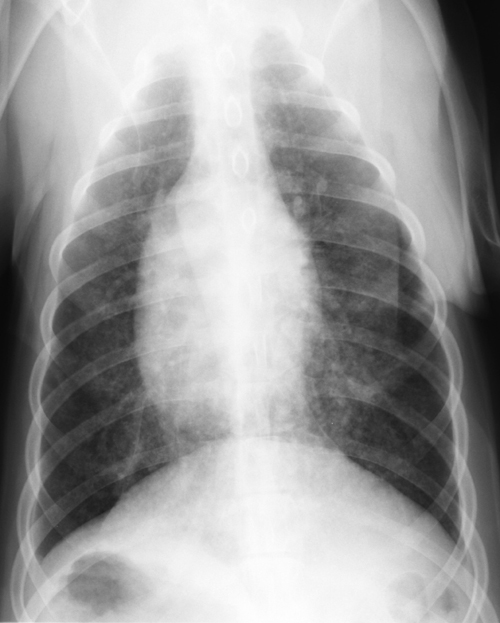 lungenkrebs hund röntgenbild