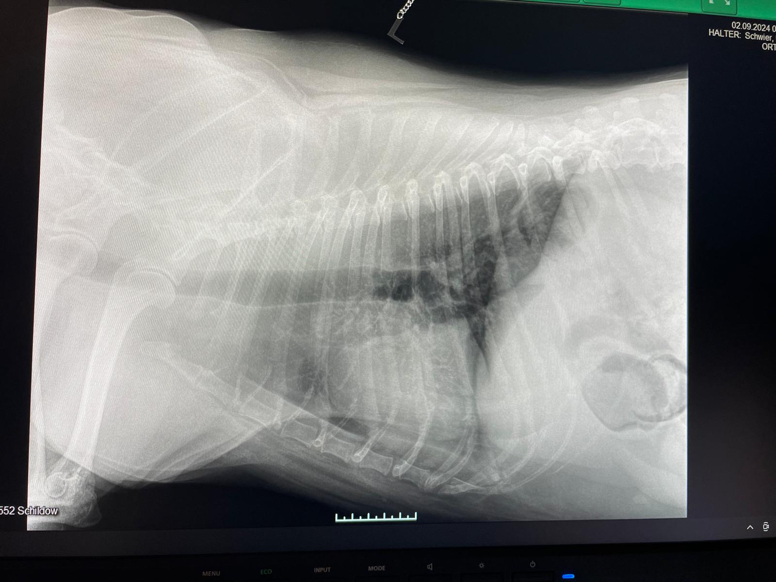 20240902_Röntgen_Thorax_1.jpeg