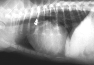 Radiograph after coil closure of PDA