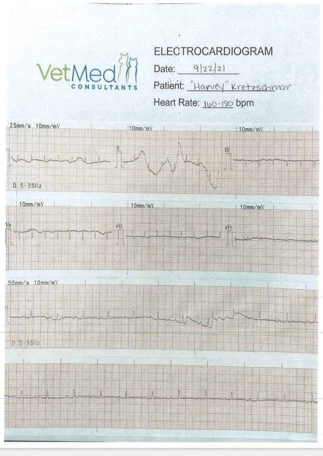 Electrocardiogram